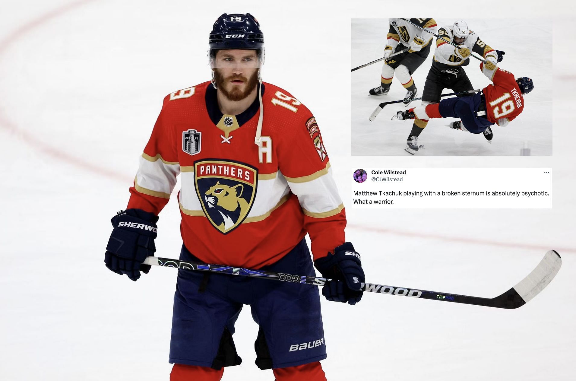 Matthew Tkachuk played Game 4 of the Stanley Cup with a broken sternum.